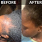 Hair Growth Elixir